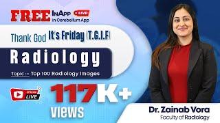 Thank God It's Friday - Top 100 Radiology Images by Dr. Zainab Vora | Cerebellum Academy