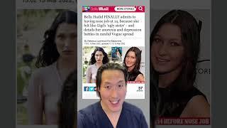 Bella Hadid Comes Clean About Her Plastic Surgery? #shorts #bellahadid