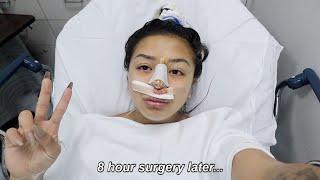 getting a nose job at 17 (surgery vlog pt.2)