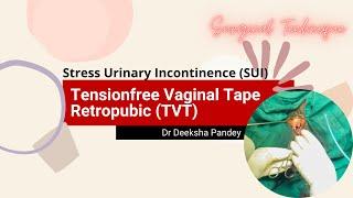 Tensionfree vaginal tape - Retropubic | TVT - Retropubic | Mid urethral sling (MUS) | TVT for SUI