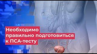 Урологи на видео объяснили, как правильно сдать анализ ПСА