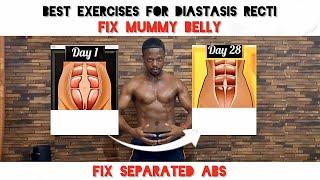 Reveal the Secret to Fixing Separated Abs: Top Exercises for Diastasis Recti