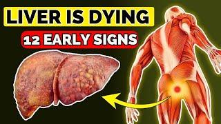 LIVER is DYING! 12 Weird Signs of LIVER DAMAGE