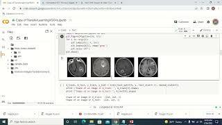Deep-learning in Health care ||  Image Classification using(VGG16)?