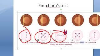 Ophthalmology Colored Halo Causes FINCHAM TEST  Coloured Halos