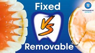 Should You Add A Fixed Retainer To Your Treatment Plan?