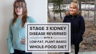 Kidney Disease Diet — How Sanna Reversed Stage 3 Kidney Disease