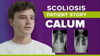 Scoliosis Pain Reduction Success: Calum's Story