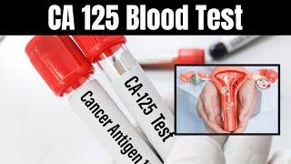 CA 125 Blood Test Explained: Uses, Procedures, and What It Means for You