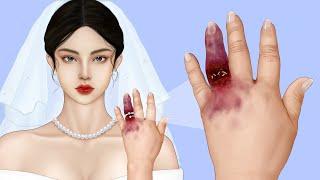 ASMR Maggot Infested Finger Removal | Severely Injured Animation