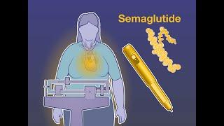 Semaglutide and Cardiovascular Outcomes in Obesity | NEJM