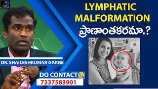 Lymphatic Malformation: Causes, Symptoms and New Treatment By Dr Shaileshkumar at CitiVascularCentre