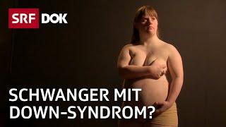 Julia Häusermann – Schwanger mit Down-Syndrom? | Doku | SRF Dok