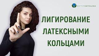 Лигирование латексными кольцами.  Проктолог женщина в Москве