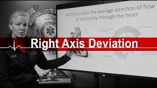 Right Axis Deviation: Understanding Electrical Flow of the Heart