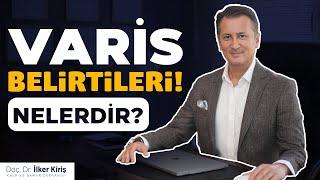 Varis Hastalığında Bacak Ağrısı | Doç. Dr. İlker Kiriş