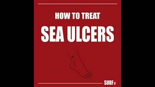 Sea Ulcer Treatment