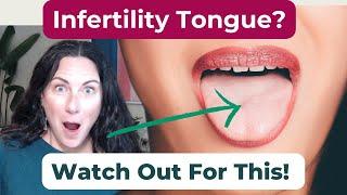 TTC: Tongue Reveals Infertility Signs