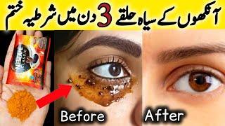 How To Remove Dark Circles in 3 Days || Dark Circles treatment || Glam Tips By Amna