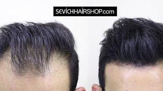 Sevich Hair Fiber Holding Spray