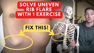 How To Fix Uneven Rib Flare with 1 Exercise! (you've never tried this before)