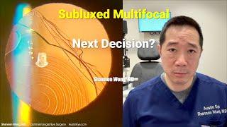 Subluxed Multifocal Lens Implant - The Choices We Make Define Who We Are.  Shannon Wong, MD