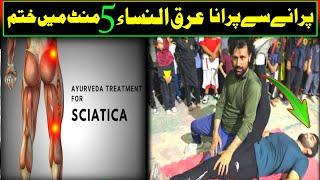Amazing Way to Cure Sciatic Pain relief