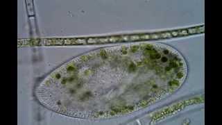 Paramecium bursaria organelles (Micronucleus and Macronucleus identified)