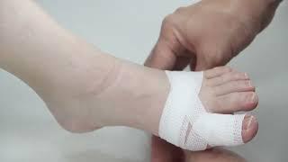 Toe Bandaging Principles and Tips