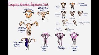 Congenital Anomalies of the Female Reproductive System