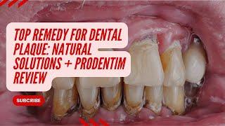 ️️Top Remedy for Dental Plaque  Natural Solutions + ProDentim Review