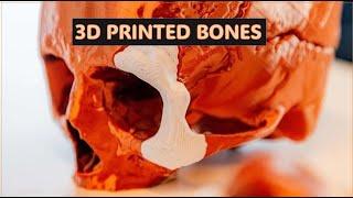 3D PRINTED BONES | Be Ready for Future Technologies !!!!