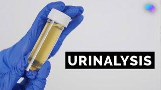 Urinalysis | Urine Dipstick Test | OSCE Guide | UKMLA | CPSA | PLAB 2