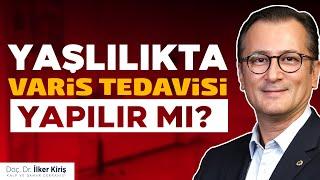 VARİSLER İLERİ YAŞLARDA TEDAVİ EDİLEBİLİR Mİ? | Doç. Dr. İlker Kiriş