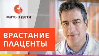  Сохранение матки, роды при врастании плаценты в Мать и дитя. Врастание плаценты. MD GROUP 18+