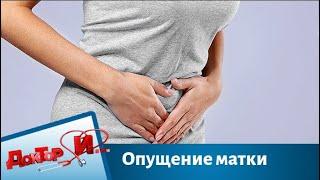 Опущение матки: причины, симптомы, лечение | Доктор И