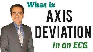 Axis Deviation in ECG Made Easy, Causes, How to determine Axis in ECG Explained, ECG Lecture USMLE