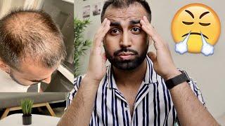 2 Month Turkey Hair Transplant UPDATE... IT GOT WORSE!