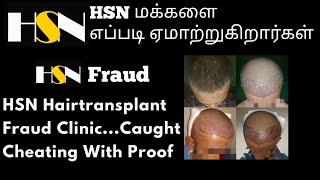 HSN Hair Transplant Fraud Cheating With Proof | HSN Bangalore And Coimbatore Full Review #AvoidHSN