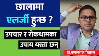 छालाको एलर्जी किन हुन्छ? Skin Allergy in Nepali | Dr. Kamal Raj Dhital  | doctor sathi