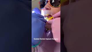 Dental Implant Surgery: Easy, Predictable, and Happy Patient #dentist #dentalcare #dentalimplants