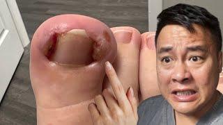 WHAT'S THAT COMING OUT OF THE TOE??