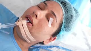 Putting a Girl into Deep Sleep - General Anesthesia - Intubation