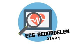 ECG Beoordelen - stap 1 (Ritme en frequentie)