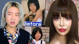 The $100,000 Doll Plastic Surgery Transformation