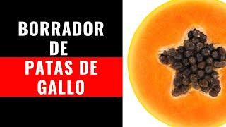  Remedios Caseros para Patas de Gallo #arrugasfaciales #cuidadonaturaldelapiel