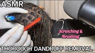 ASMRVery Intense Scalp Scratching/Nitpicking on Old Braids with toothbrush & Comb*Dandruff Removal*