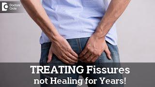Best ways to manage Fissures that are not healing for long time - Dr. Nanda Rajneesh|Doctors' Circle