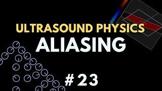 Aliasing Artifact | Ultrasound Physics Course | Radiology Physics Course #23