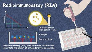 Radioimmunoassay( RIA)